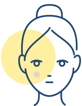 しみ