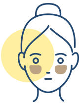 肝斑