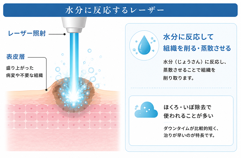 CO2(炭酸ガス)レーザー